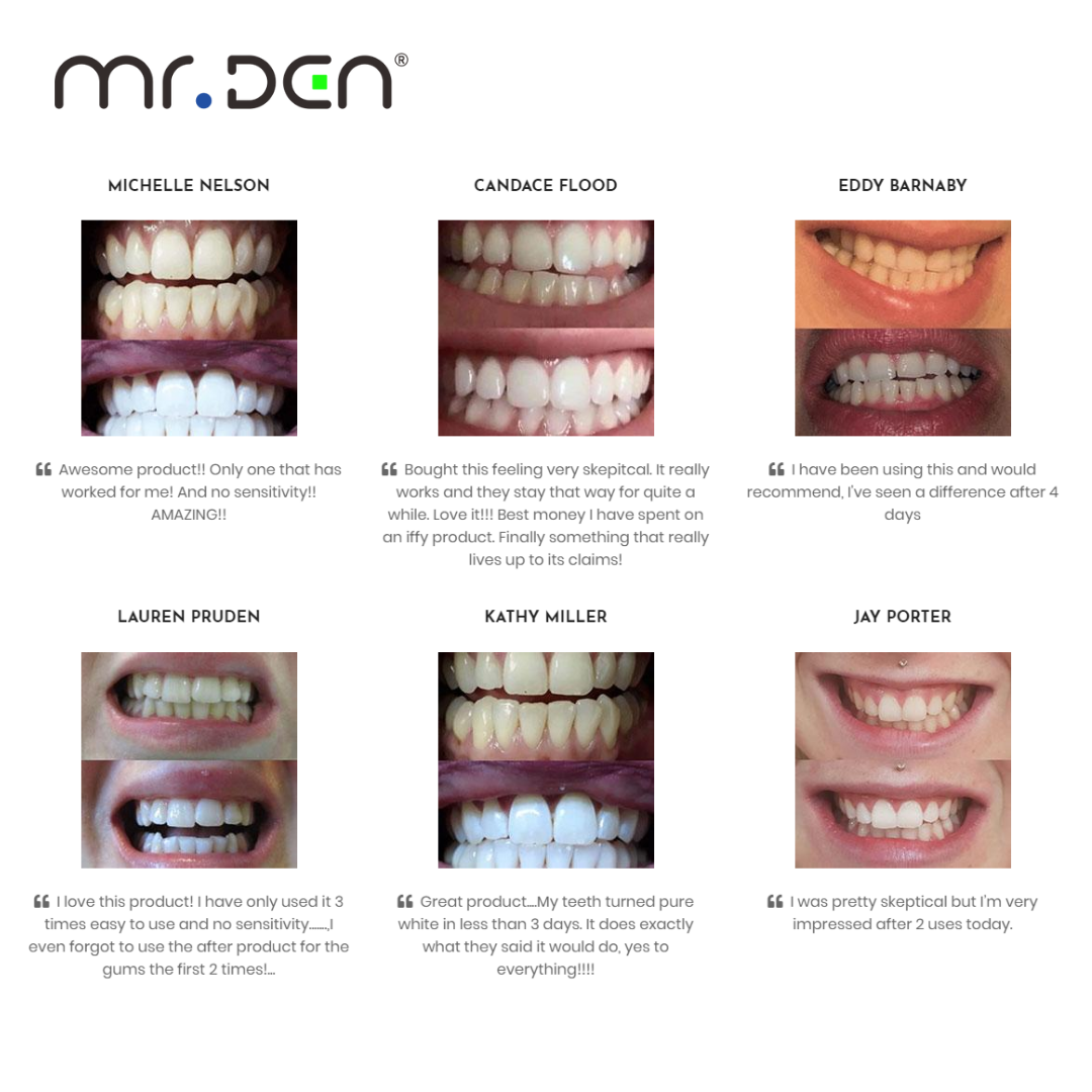 Dr. Whiten 3 Pack Teeth Whiten - Teeth Whitening Light 리뷰 및 가격