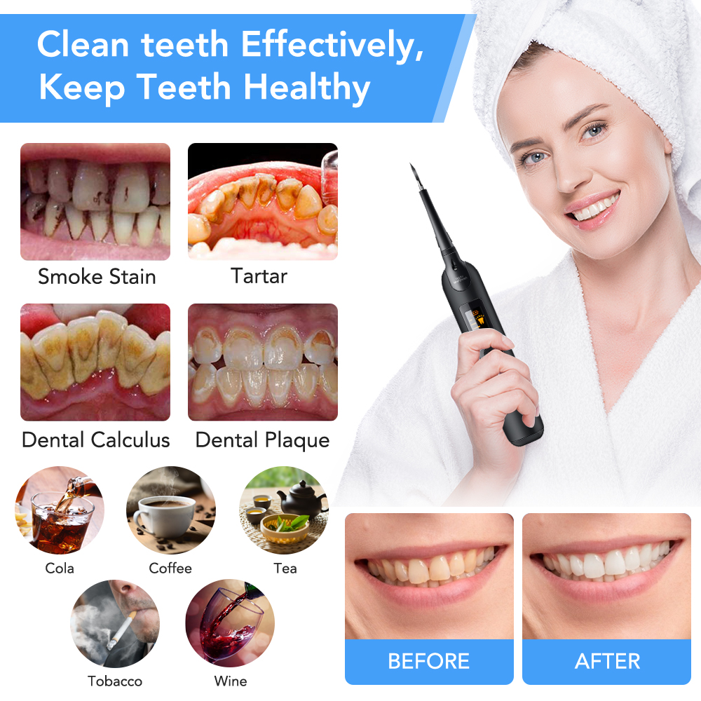 Teeth Tartar Remover Electric  - Teeth Whitening Vape 리뷰 및 가격