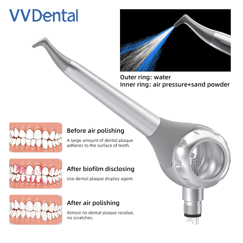 VV Dental 2/4 Holes Teeth Whit - Teeth Whitening Dental 리뷰 및 가격