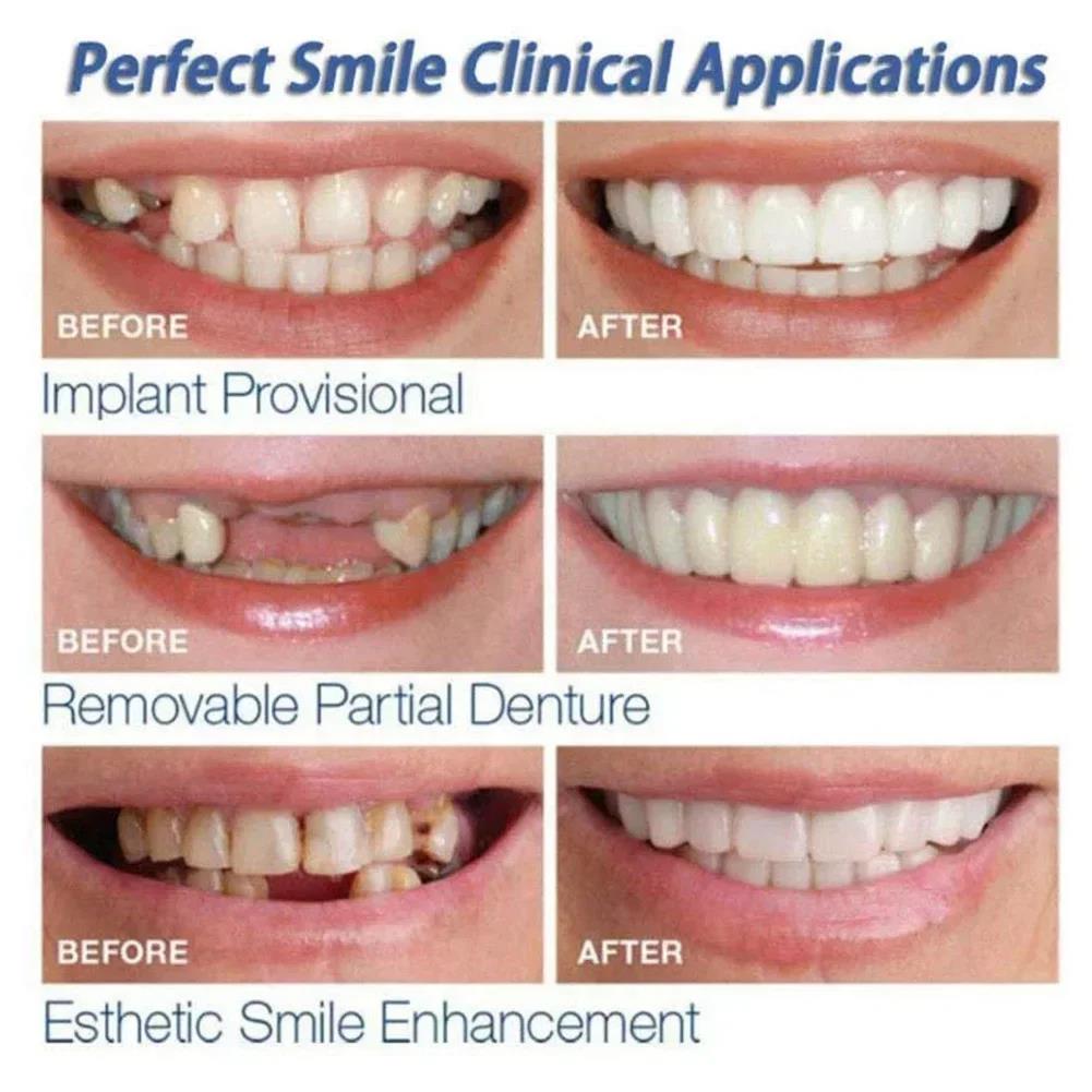 Best Sellers  Teeth Kit Fake T - Teeth Whitening Vape 리뷰 및 가격