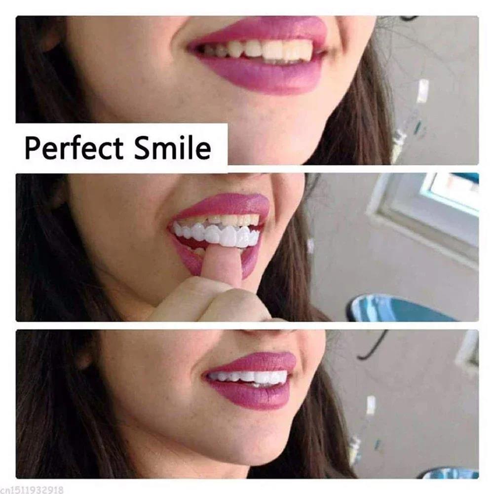 Best Sellers  Teeth Kit Fake T - Teeth Whitening Vape 리뷰 및 가격
