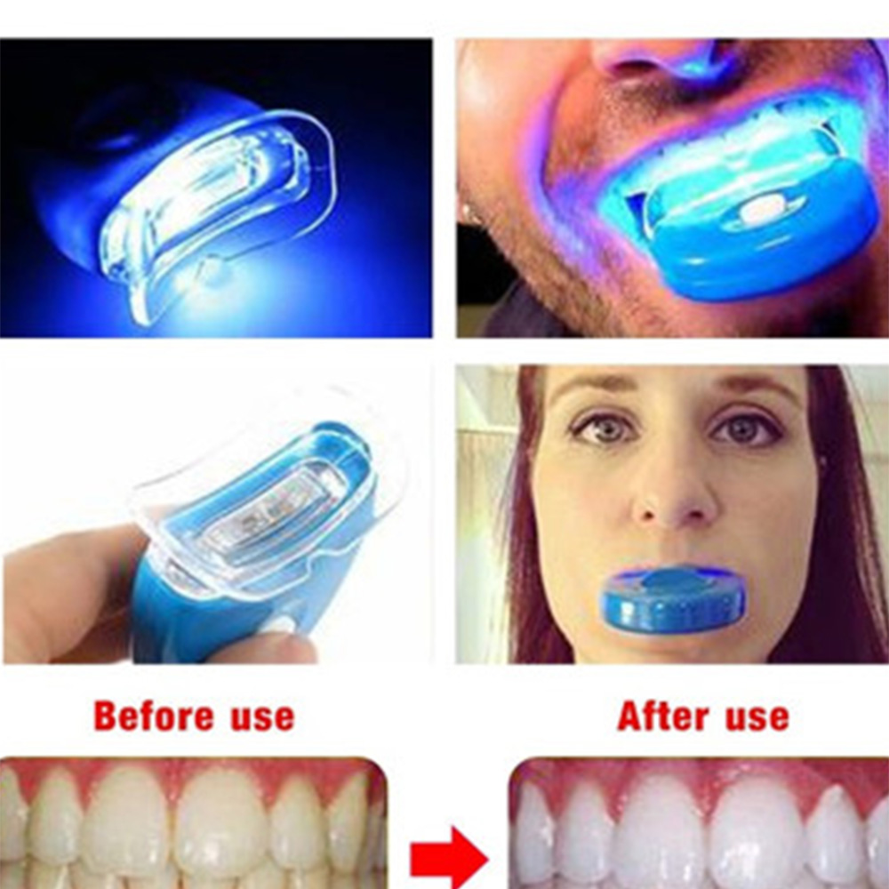 New Blue Led Teeth Whitening A - Teeth Whitening Laser 리뷰 및 가격